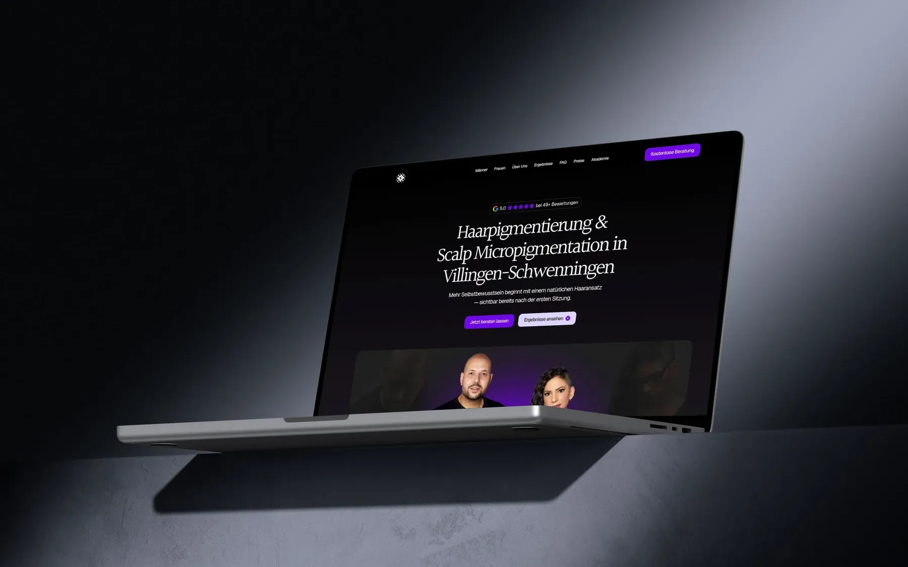 Scalp Couple website for scalp micropigmentation services in Germany